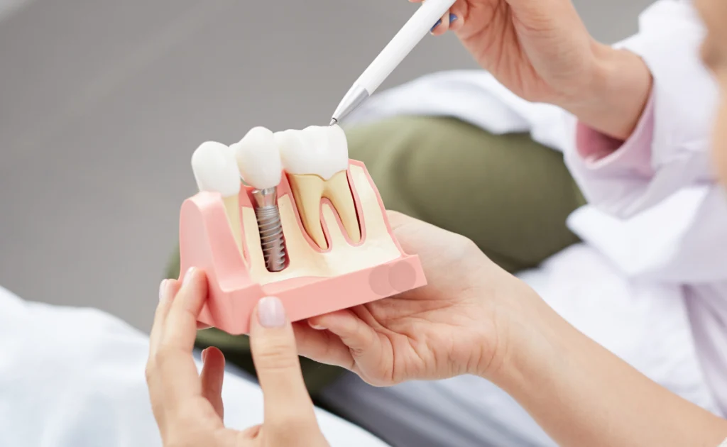 Implant dentaire